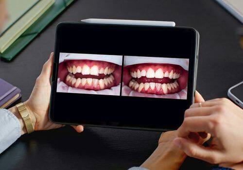 Dental images being viewed on a tablet